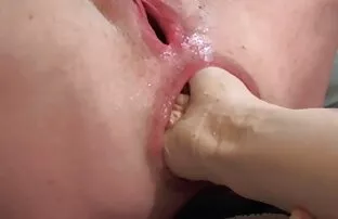 XXX دو ماساژ درمانی با چوب خود عکس سکسی دختر 18 مشتری را شگفت زده کردند